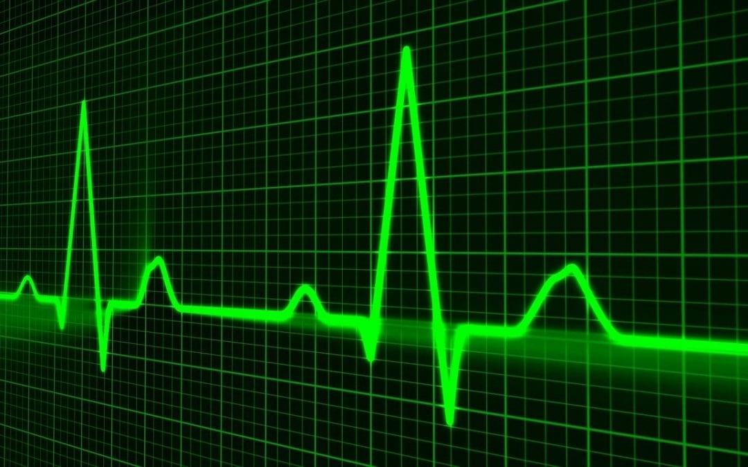 What is Supraventricular Tachycardia (SVT)?